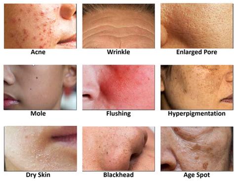 Skin Conditions