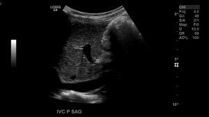 Sonography image 6