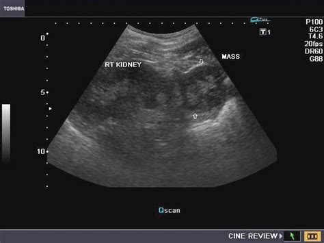 Sonography Images