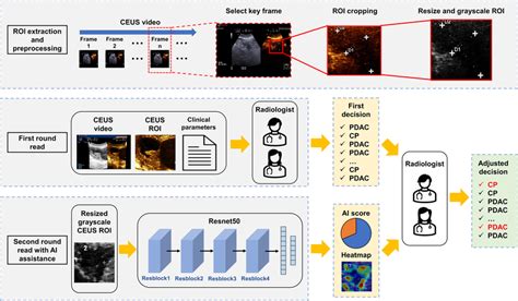 STAR CEUS artificial intelligence training