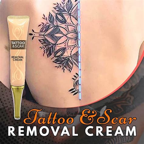 Tattoo removal creams and gels