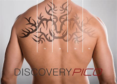 Tattoo removal in Augusta