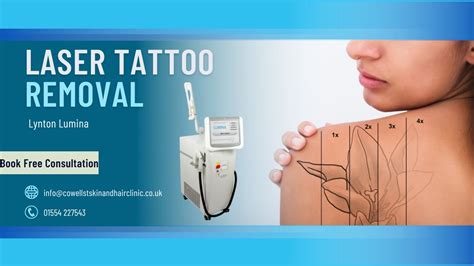 Tattoo Removal Near Me