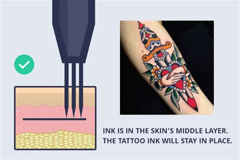 Tattoo techniques