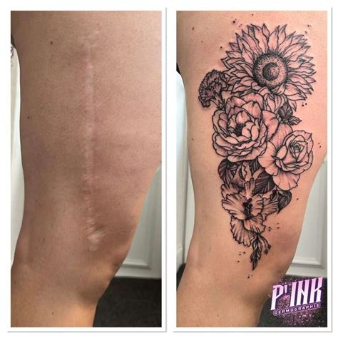 Tattooing over scars gallery 7