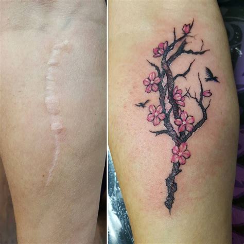 Tattoos for scar coverage