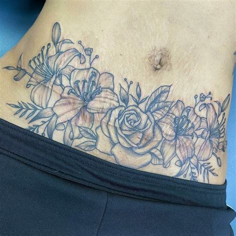 Tummy Tuck and Tattoos Example 1