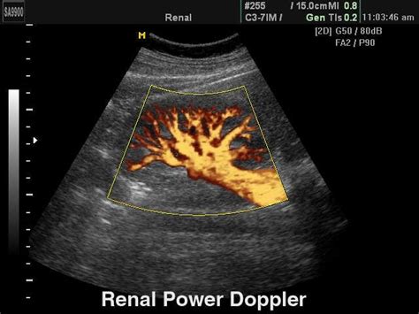 Ultrasound Sonography Image 1