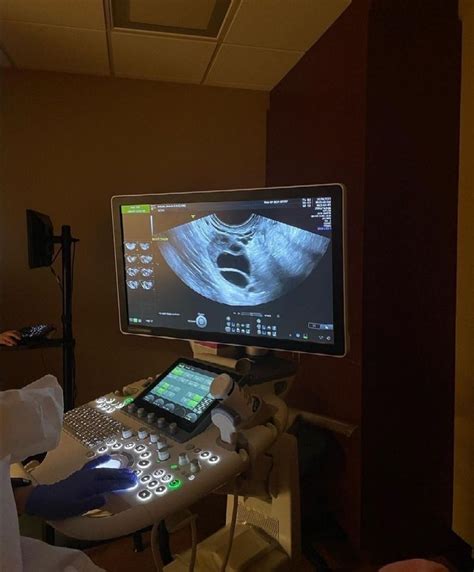 Ultrasound Tech Images Gallery