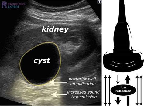 Ultrasound Techniques