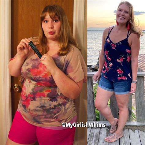 Weight loss success stories